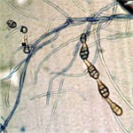 Alternaria photomicrograph