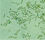 Cladosporium photomicrograph