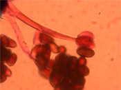 Stachybotrys photomicrograph